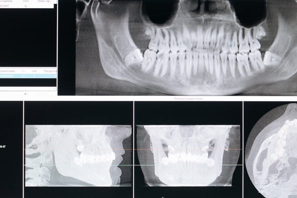 radiografias-santos-dental